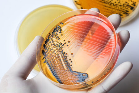 Scientist's,Hand,In,Latex,Glove,Holding,The,Bacteria,Growing,Petri