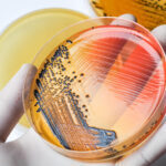 Scientist's,Hand,In,Latex,Glove,Holding,The,Bacteria,Growing,Petri